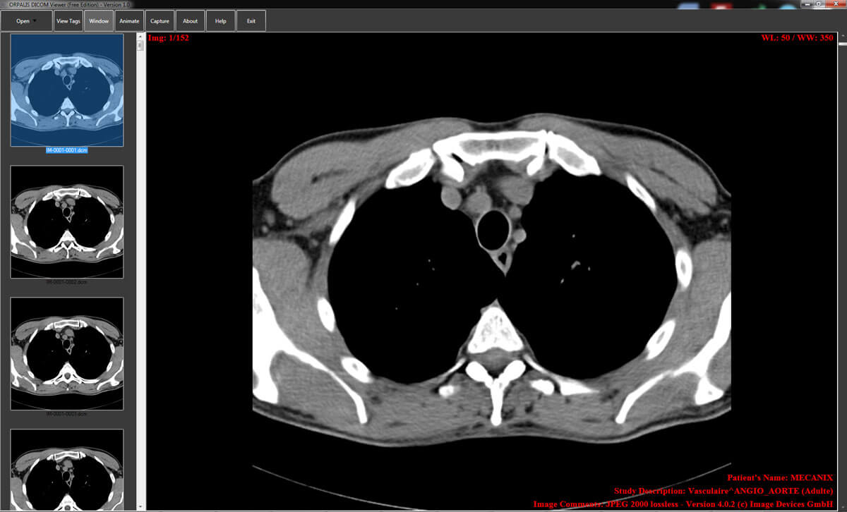 OrpalisDicomViewer - Presented by PostDICOM